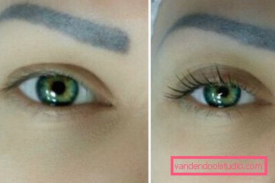 Pre i posle procedure Pre i posle procedure