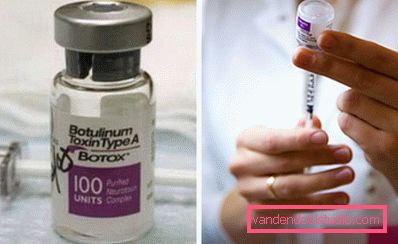 botox ampula