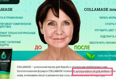 pre i posle pre i posle