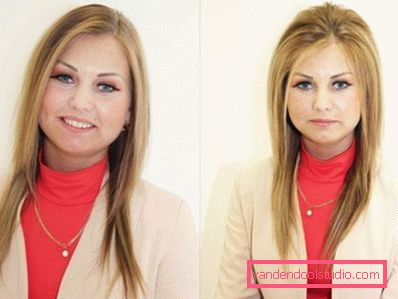 Radikalna zapremina kose Boost Up (Boost UP) - sve o proceduri