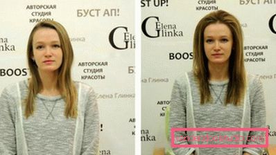 Radikalna zapremina kose Boost Up (Boost UP) - sve o proceduri