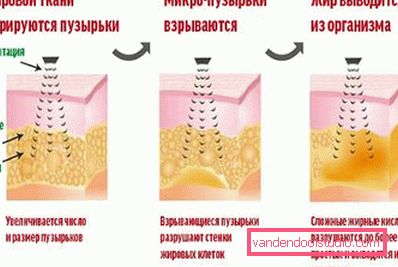 šema djelovanja šema djelovanja