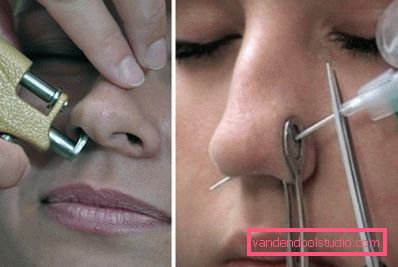 procedure procedure
